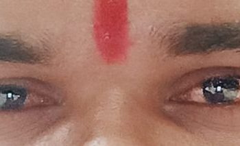 आँखा पाक्ने रोग लागिहाले के गर्ने ?